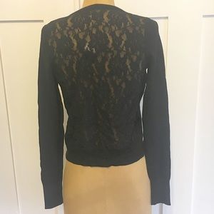 Express Cardigan Lace Back
